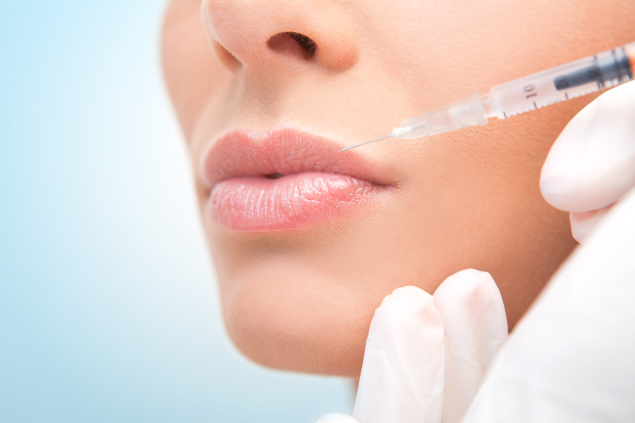 Image of a woman receiving Juvederm lip filler