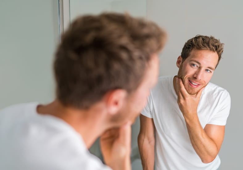 Man with hair loss after iRestore