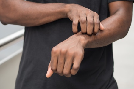 African-American man scratching at itchy skin