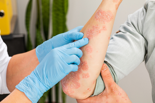 Examination and diagnosis of skin diseases-allergies, psoriasis, eczema, dermatitis